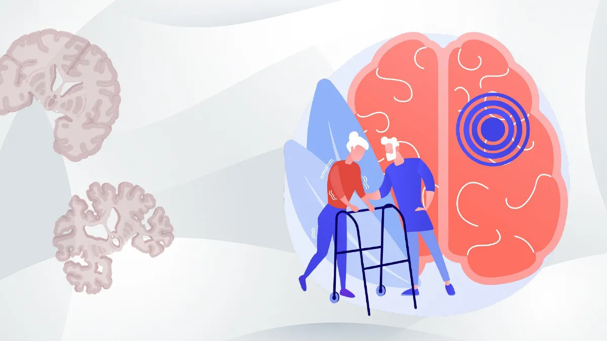 Más allá de la memoria: cuando el deterioro cognitivo afecta también el movimiento